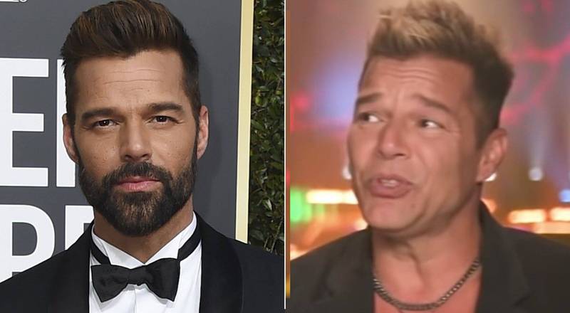 Ricky Martin enfrenta ola de críticas al lucir un rostro diferente – Activo