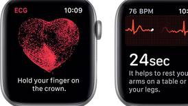 ¿Son confiables los electrocardiogramas de los smartwatches? Expertos en salud responden