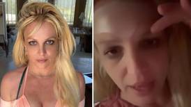 El bótox y sus peligros: Britney Spears y los serios problemas que le ocasionó en el rostro