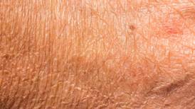 Nuevo estudio de la Universidad de California junto a L’Oréal revela la causa de las arrugas